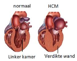 HCM